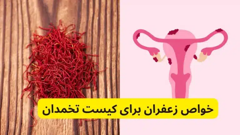 خواص زعفران برای کیست تخمدان